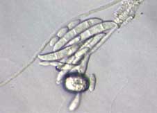 Figur 8. Eksempler på svampe isoleret fra rødder i kulturer fra Brøndlundgård, Fusarium oxysporum var redolens