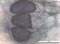 Figur 12. Arbuskulær mykorrhiza i hvidel  b og c) vesikler