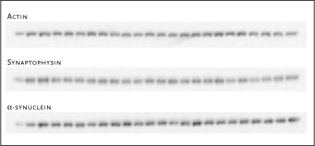 Figur 11. Eksempel på et repræsentativt western blot af actin, synaptophysin og α-synuclein i prøver fra corpus striatum. Figuren viser, for hvert af de 3 proteiner, 24 prøver hvoraf de 3 første fra venstre er kontrolprøver (kontrolhold) i vævskoncentrationerne 2,5 µg, 5 µg og 7,5 µg protein. Resten er prøver i vævskoncentrationen 5 µg protein.