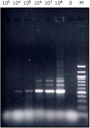 Billede af PCR produkter