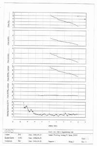 Flowlog, boring P1 (Kote DNN) Klik for at se billedet i naturlig størrelse