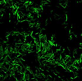 Figur 1. Bt bakterier m&aelig;rket med GFP (gr&oslash;nfluorescerende protein)