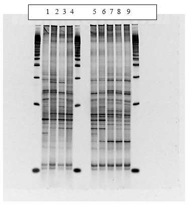Figur 1.8.2. DGGE af Dyr 2 fra Hold 1. Bane 1-3: pr&oslash;ver fra f&oslash;r dosering; bane 4-6: pr&oslash;ver under dosering; bane 7-9: pr&oslash;ver efter dosering.