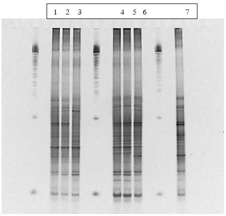 Figur 1.9.2. DGGE af Dyr 3 fra Hold 1. Bane 1-3: pr&oslash;ver fra f&oslash;r dosering; bane 4-6: pr&oslash;ver under dosering; bane 7: pr&oslash;ve efter dosering