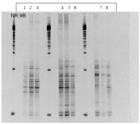Figur 1.9.6. DGGE af Dyr 15 fra Hold 3. Bane 1-3: pr&oslash;ver fra f&oslash;r dosering; bane 4-6: pr&oslash;ver under dosering; bane 7-9: pr&oslash;ver efter dosering