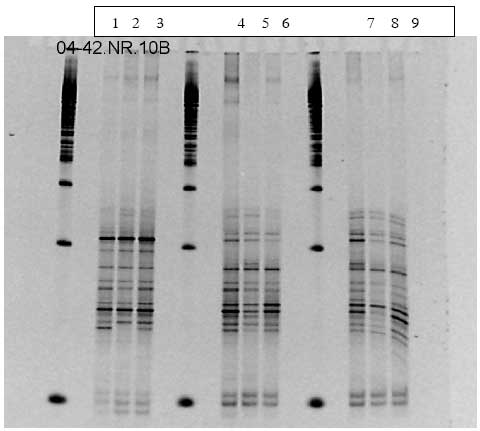 Figur 1.9.7. DGGE af Dyr 20 fra Hold 4. Bane 1-3: pr&oslash;ver fra f&oslash;r dosering; bane 4-6: pr&oslash;ver under dosering; bane 7-9: pr&oslash;ver efter dosering