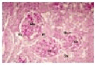 Figure 6.1.1 Histological findings in Group 1. No changes are seen neither in the mesangium nor in the basement membranes, the glomeruli or the tubules. Abbreviations used: Glo: glomerulus, Me: mesangium, Pt: proximale tubules, Hi: hilus, Dt: distale tubules, Gb: glomerulare basale membrane, Bb:Bowmann’s basale membrane (PAS, 250x). 