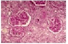 Figure. 6.1.5. Histopathological findings in Group 3 and 4. Note the glomerular fibrosis (1), the infiltration of mononuclear cells (2), the necrotic tubules (3) and the segmental thickening of the basement membrane (4) (PAS, 250x). 