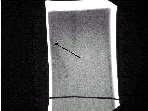 Figur 35. Røntgenoptagelse af klods med angreb på siden
