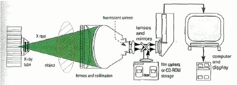 Figur 25. Illustration af røntgenteknik