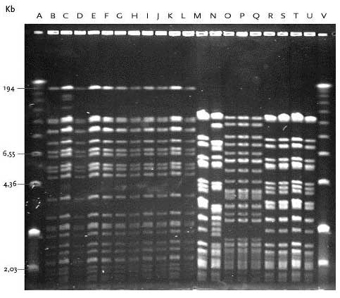 Figur 14 PFGE typer af E. faecium med DNA skåret med skæringsenzymet SmaI
