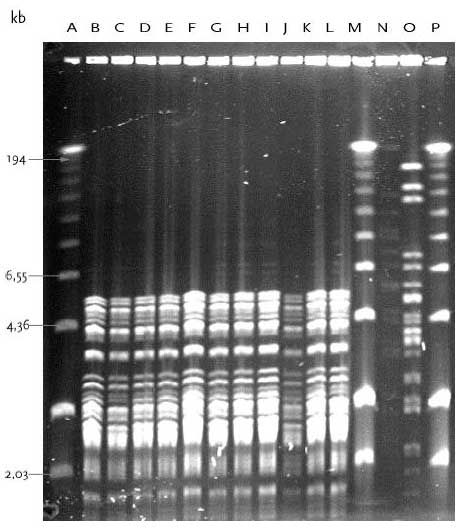 Figur 15 PFGE typer af E. gallinarum samt E. mundtii og E. hirae med DNA skåret med skæringsenzymet SmaI