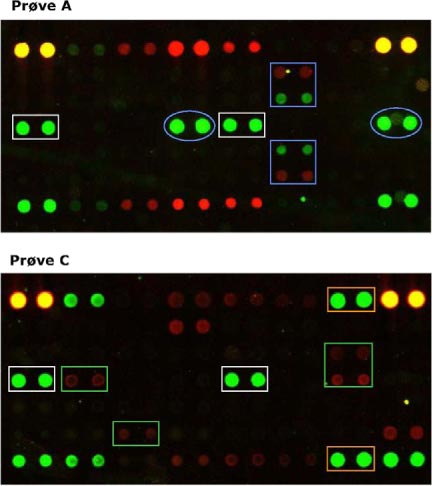 Figur 6: Resultat af DNA-chip-analyse af suspensionsprøver: Prøve A (10<sup>6</sup>) (øverst) og prøve C (10<sup>6</sup>) (nederst). Prøve A (10<sup>6</sup>) indeholder Campylobacter jejuni, Aeromonas spp. og Pseudomonas aeruginosa. Prøve C (10<sup>6</sup>) indeholder Campylobacter jejuni, Legionella pneumophila og Salmonella spp.